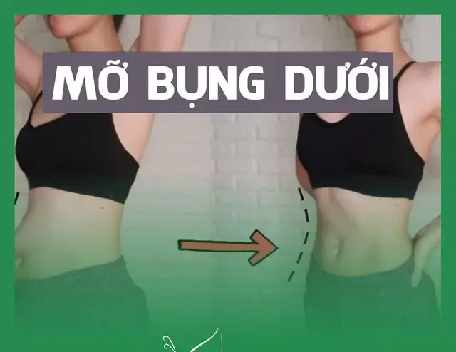 Nguyên Nhân Nào Khiến Mỡ Bụng Dưới Khó Giảm Dù Ăn Kiêng? 1 nguyen nhan nao khien mo bung duoi kho giam du an kieng 68556819754d5
