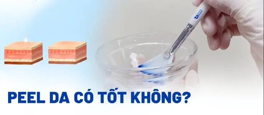 Peel Da Có Tốt Cho Da Mụn Không? 1 peel da co tot cho da mun khong 685568a79e1fb